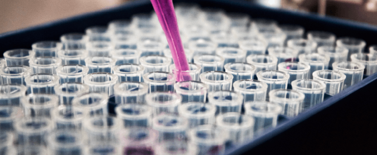 Imagen de unas pipetas de muestras dentro de una bandeja de laboratorio